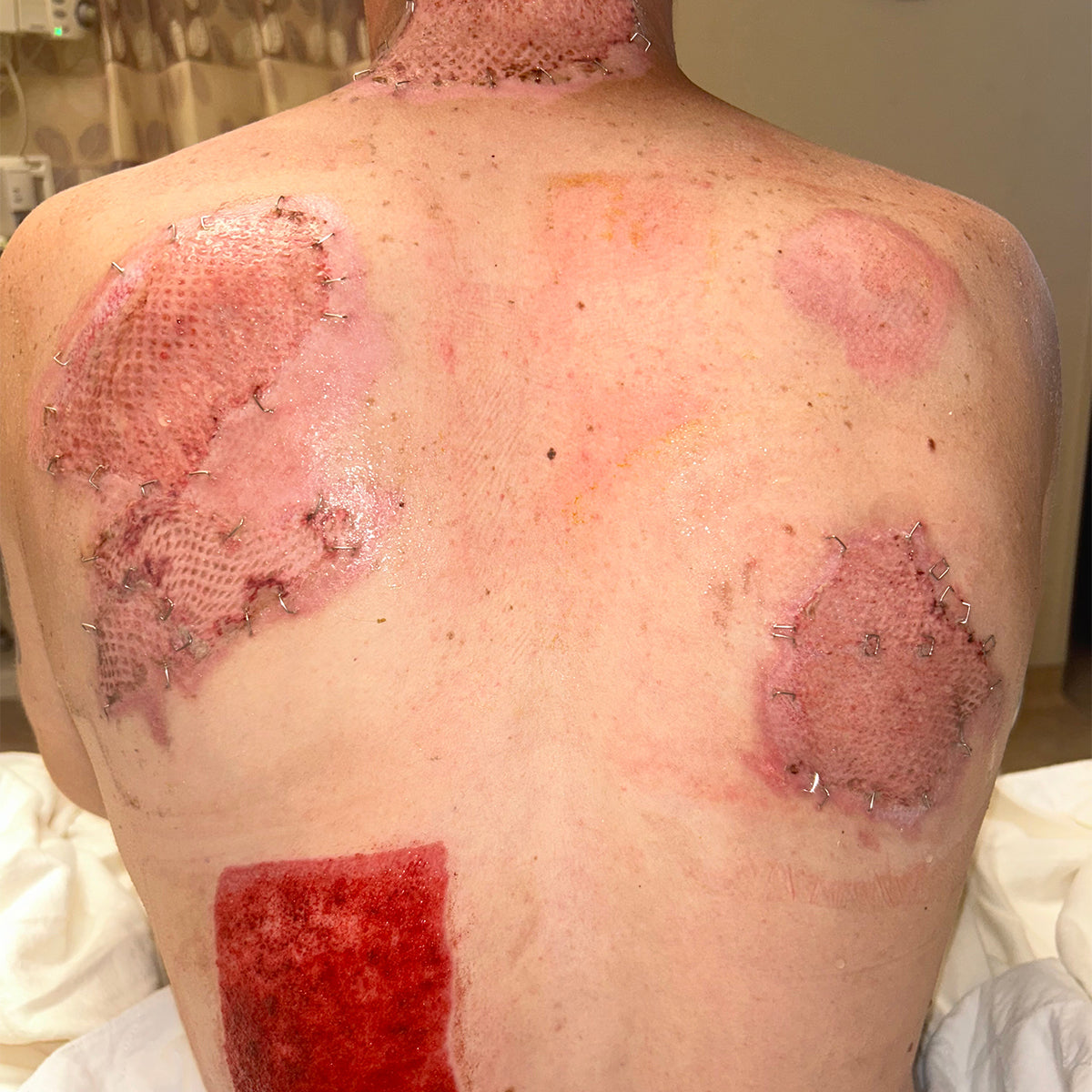 People's Champ Contestant - Neil Norgren